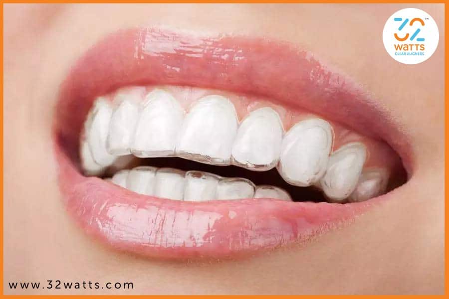 Health Benefits of Straighter Teeth