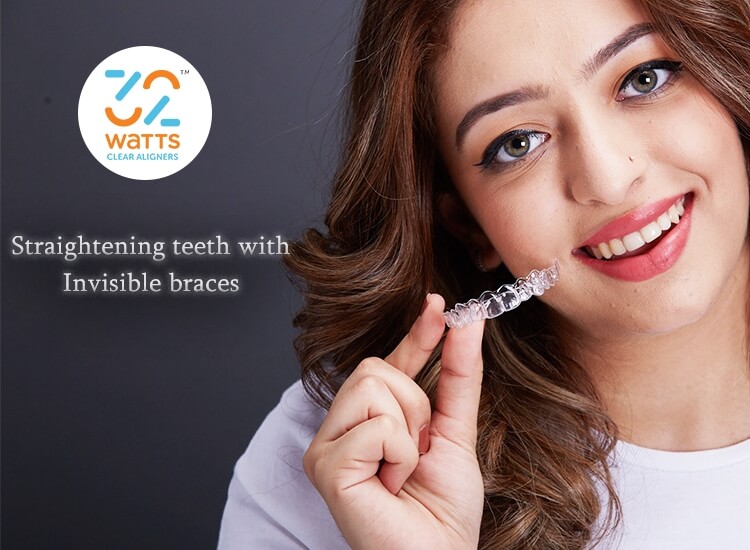 Clear Aligners Cost In Dubai Uae Best Invisible Braces In Dubai