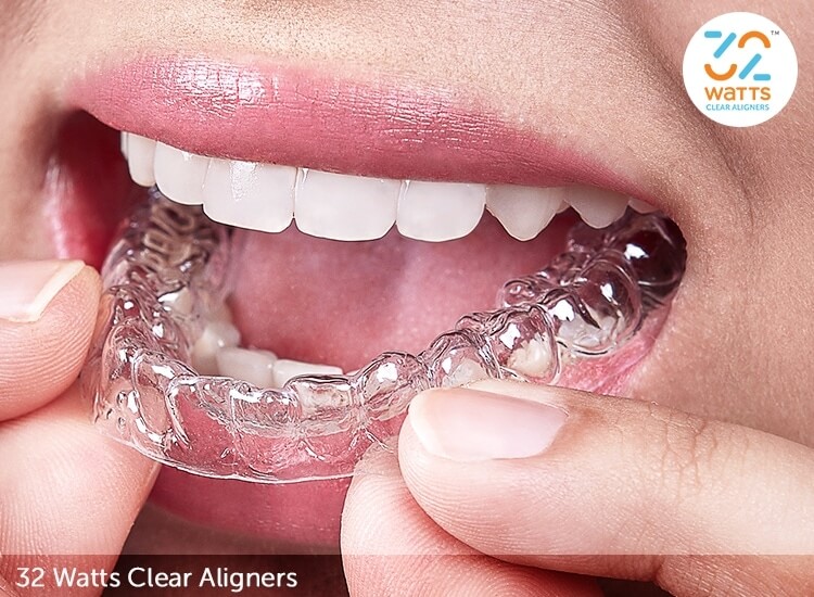 Clear Aligners Cost in Singapore